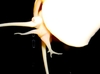Bilde